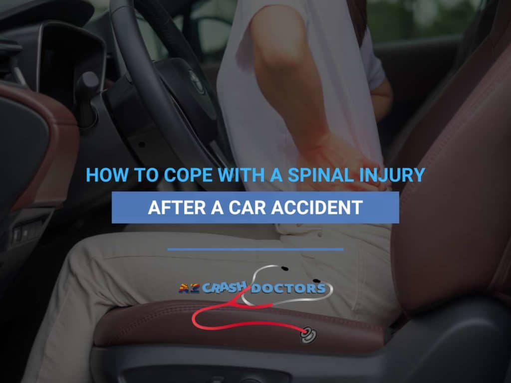 How To Cope With a Spinal Injury After a Car Accident